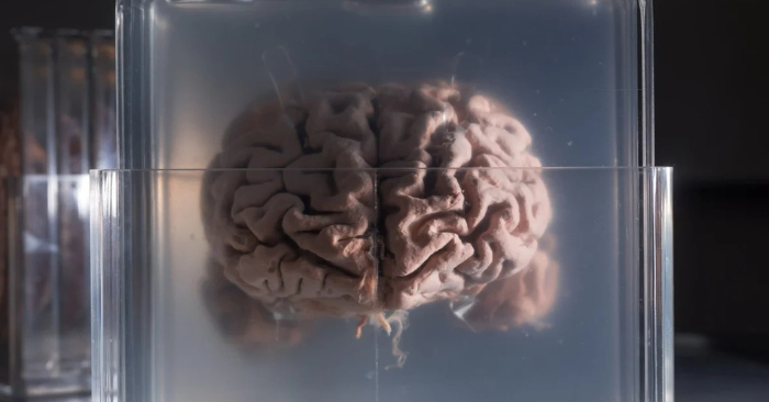 Công nghệ mới mở đường giải mã bộ não Einstein