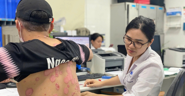 Bệnh vảy nến và những biến chứng nguy hiểm ít ai ngờ