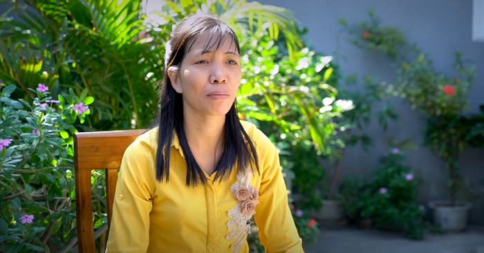 Bị u xương sụn ăn mòn tưởng chừng suốt đời tàn phế