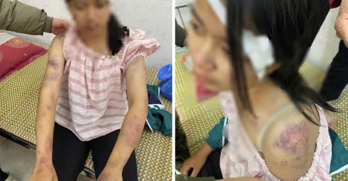 bạo hành trẻ em Thái Nguyên Linh Sơn