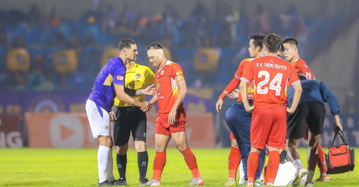 Trọng Hoàng suýt bị rách tai