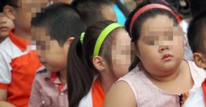Béo phì khiến hơn 20 triệu người Việt đối mặt vòng xoắn bệnh lý