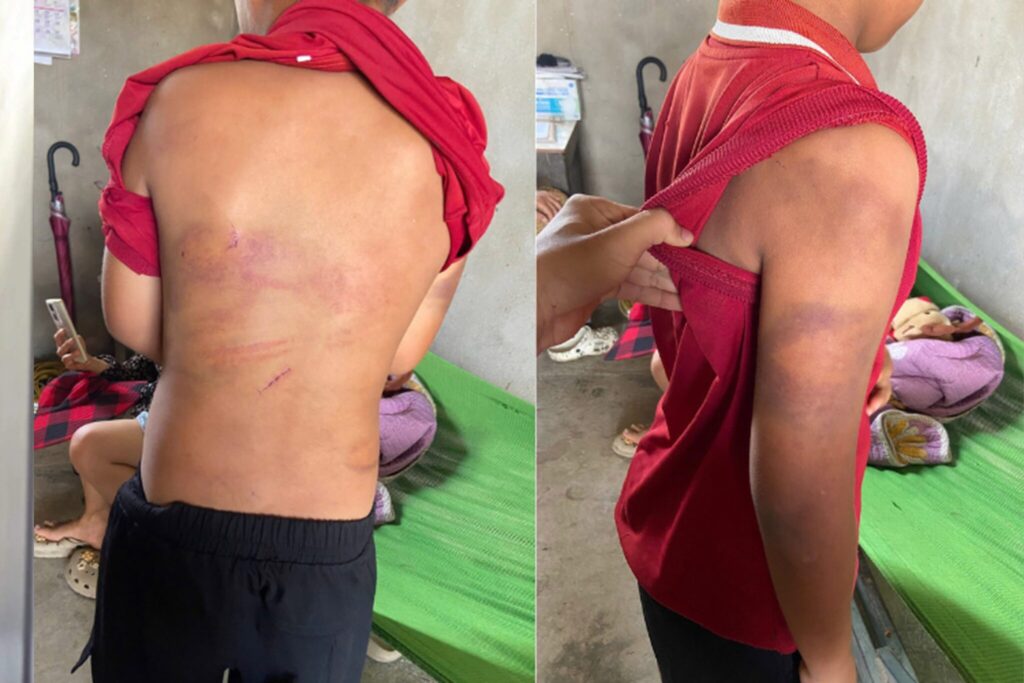 Cha ruột bạo hành con trai tại Nghệ An